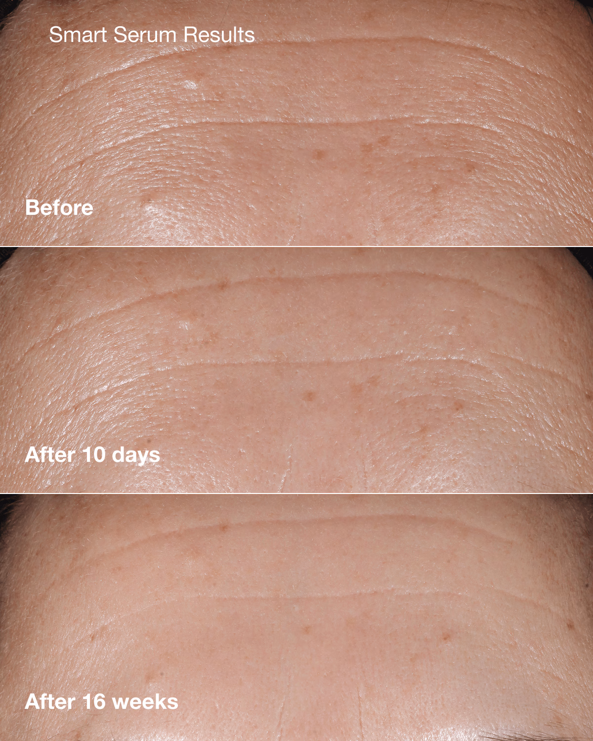 Anti-Aging Skincare Bundle