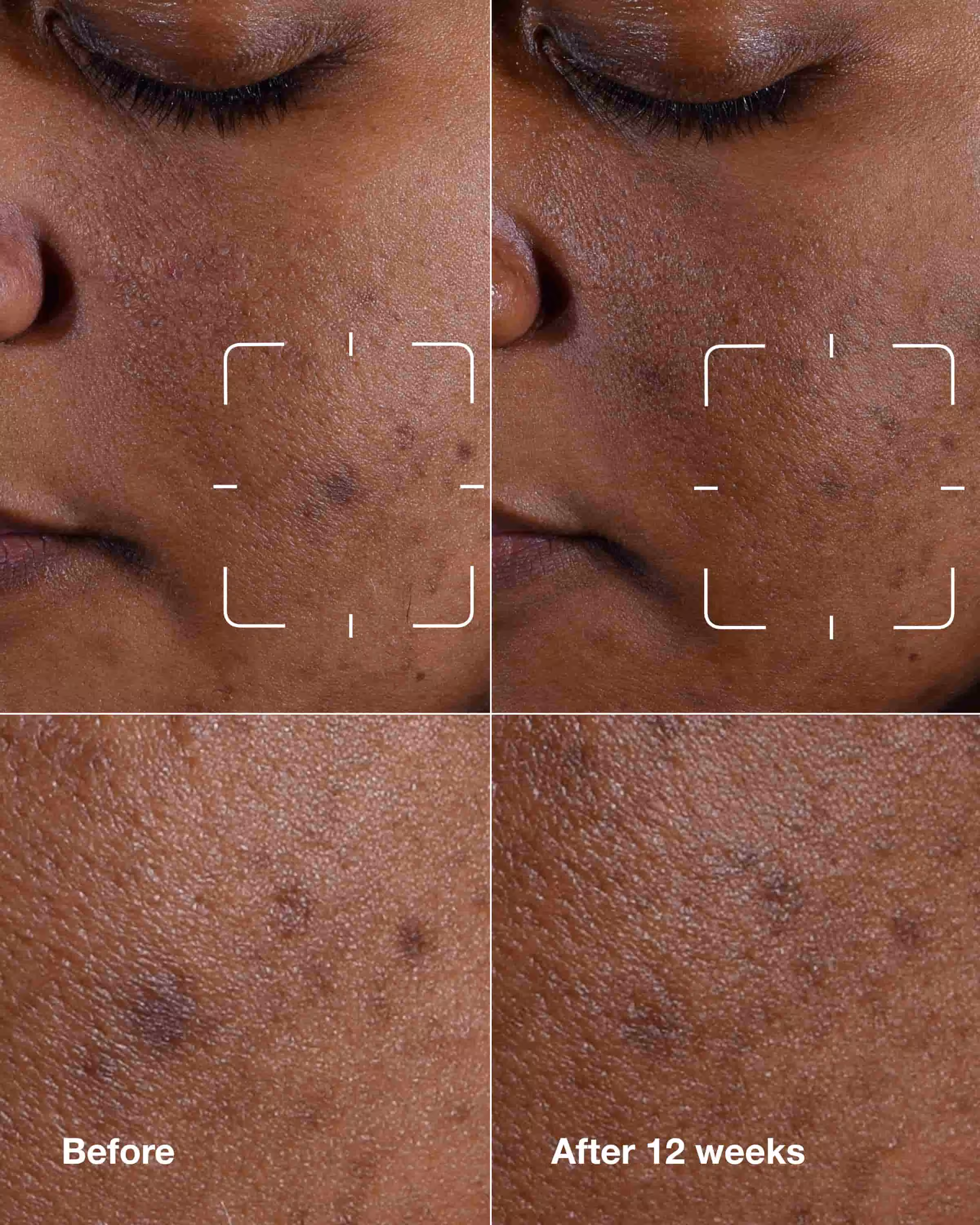 Brightening Routine: Mini Even Better Skincare Kit