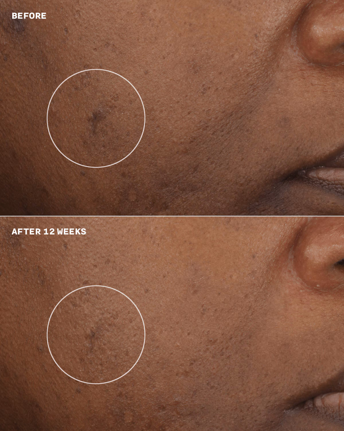 Brightening Routine: Mini Even Better Skincare Kit