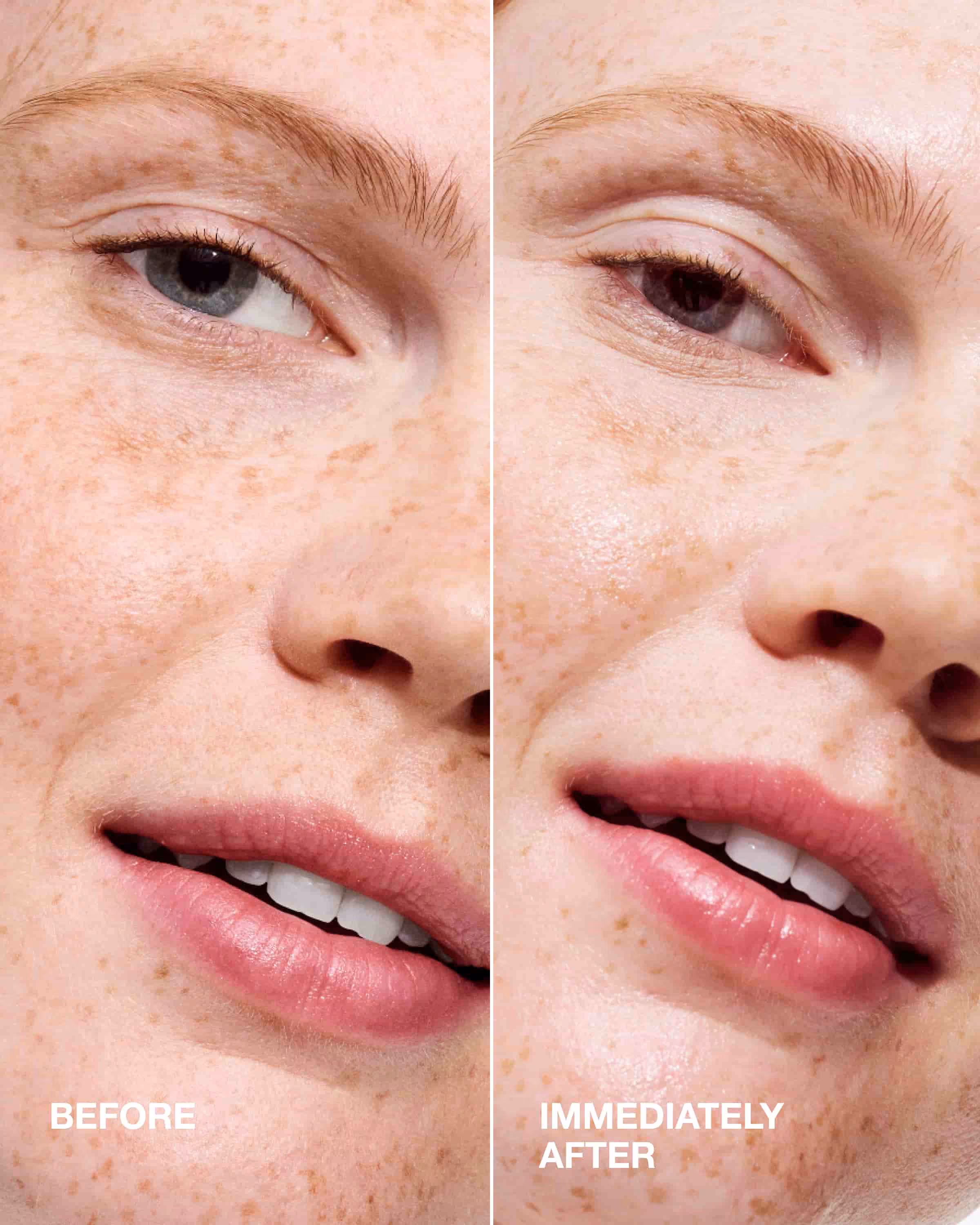 Moisture Surge™ Active Glow Serum