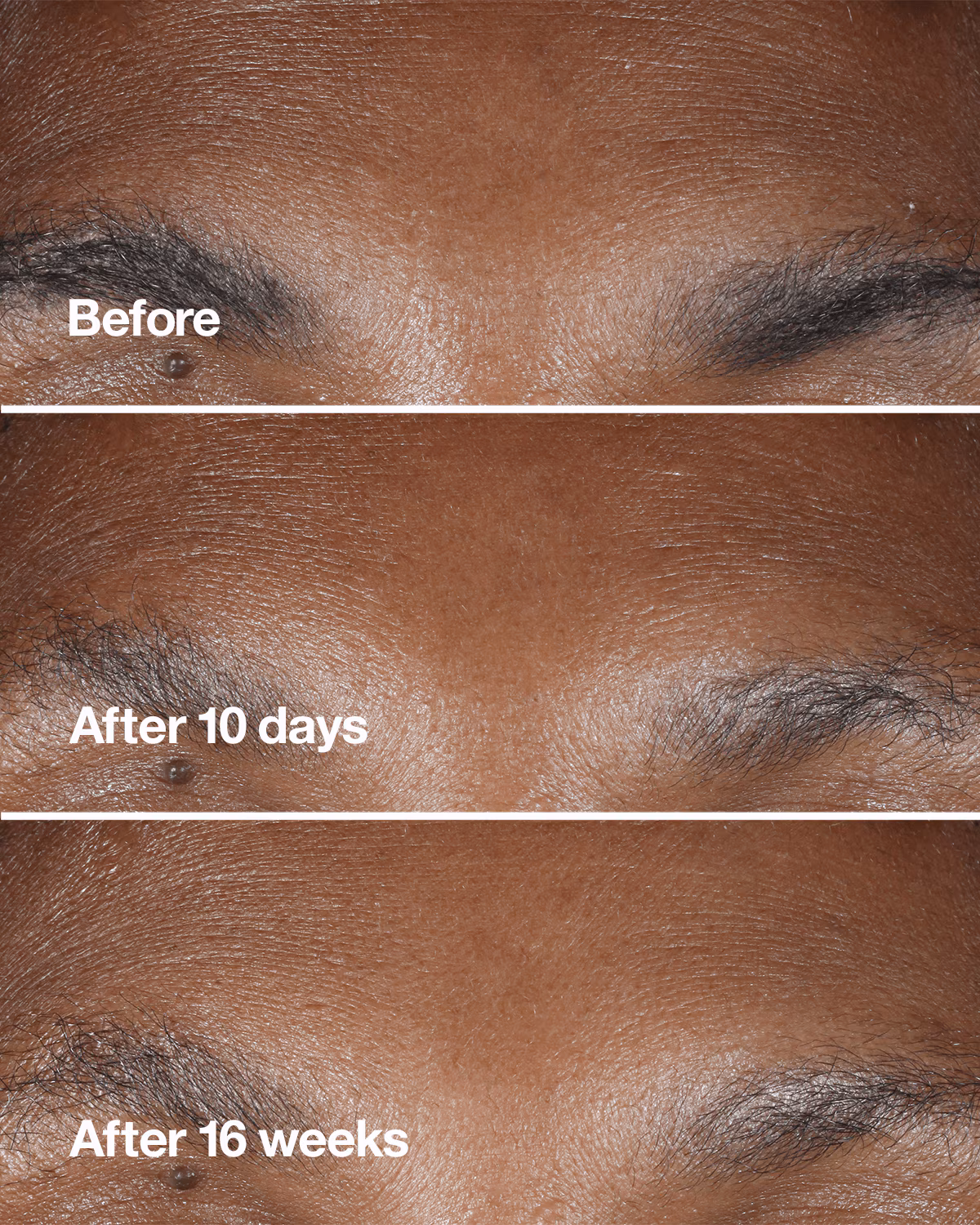 Clinique Smart Clinical Repair™ Wrinkle Correcting Serum