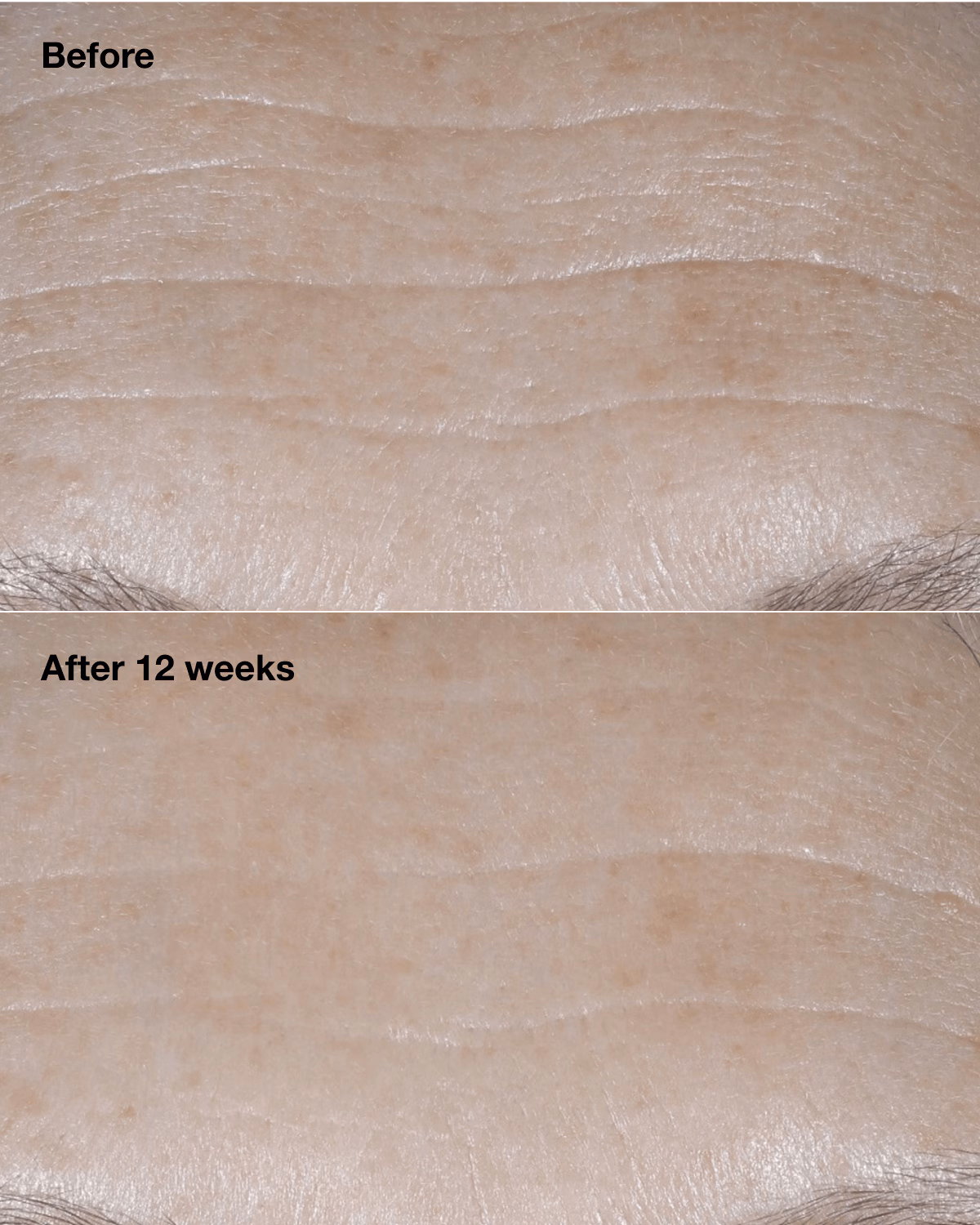 Clinique Smart Clinical Repair™ Broad Spectrum SPF 30 Wrinkle Correcting Cream