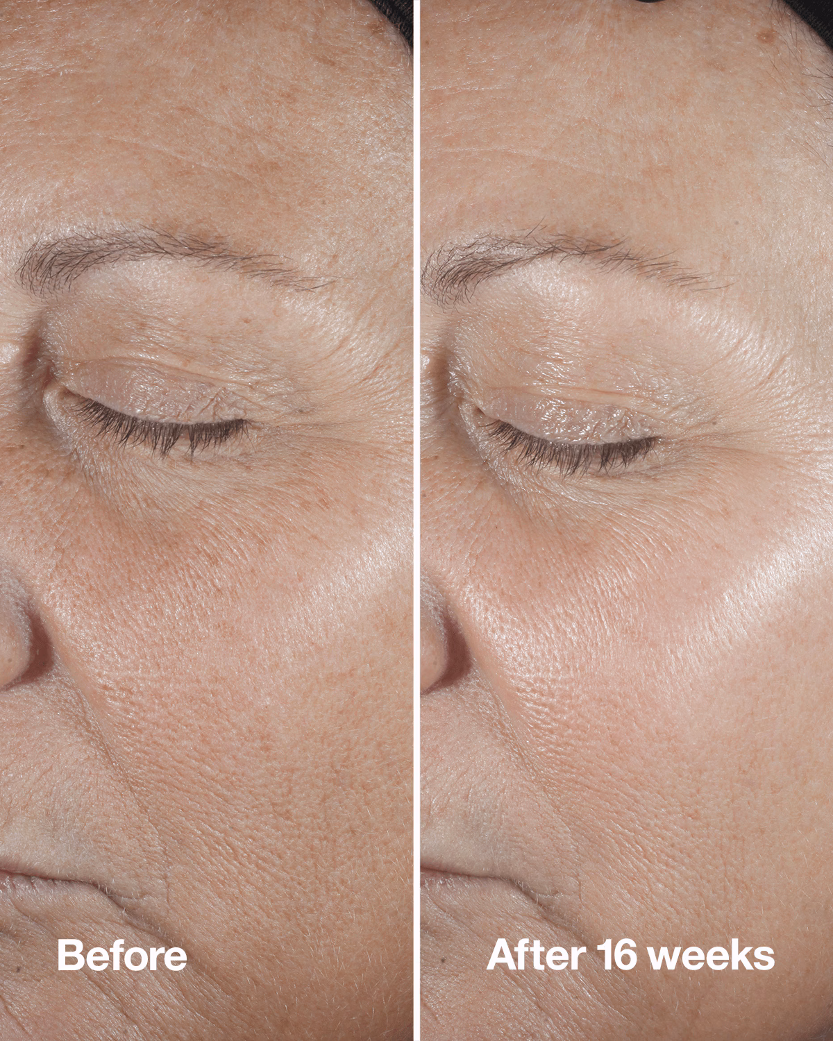 Clinique Smart Clinical Repair™ Wrinkle Correcting Serum