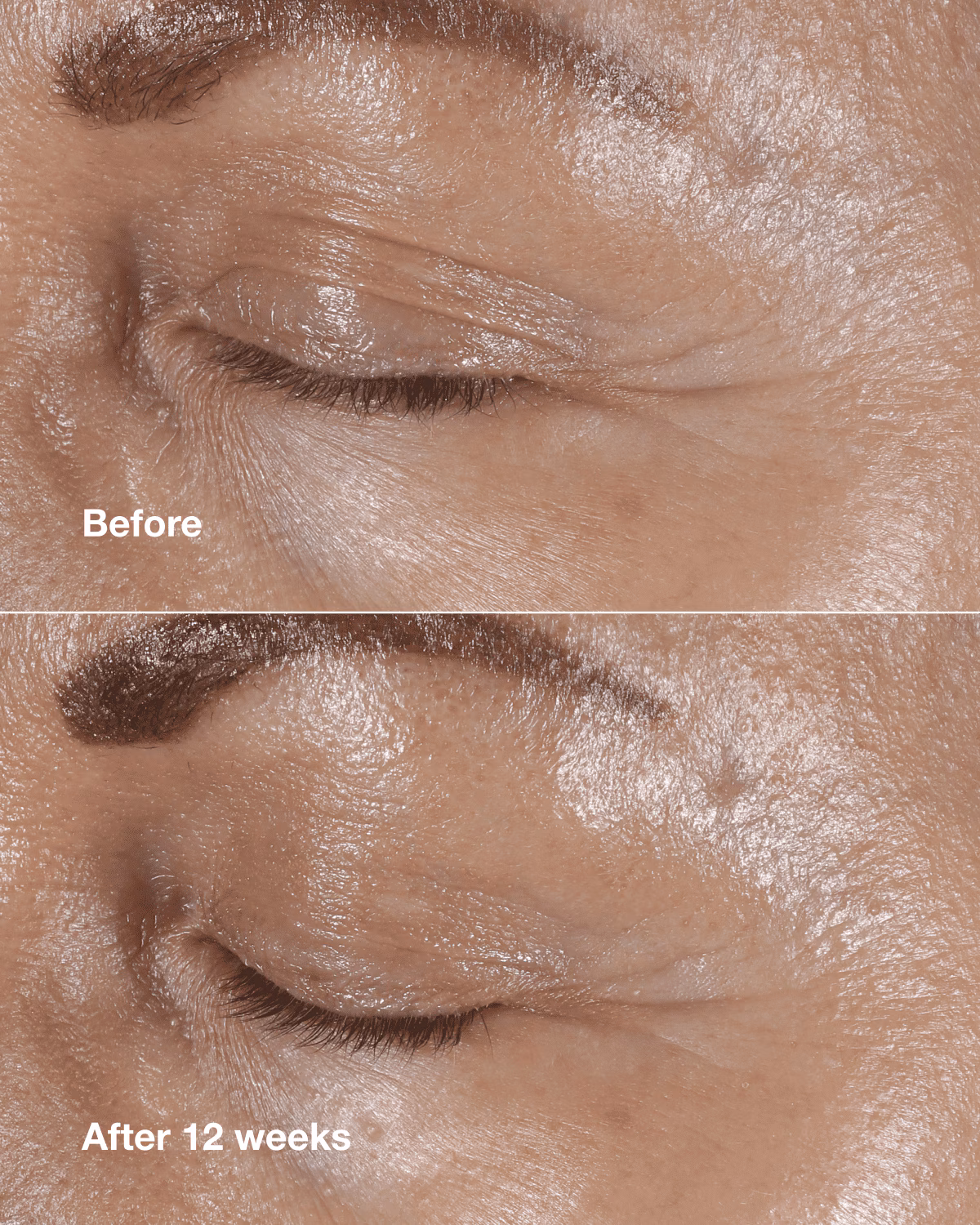 Anti-Aging Routine: Mini Smart Clinical Repair Kit