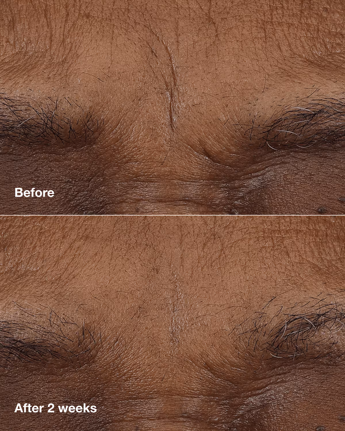 Clinique Smart Clinical Repair™ AM/PM Retinoid Balm