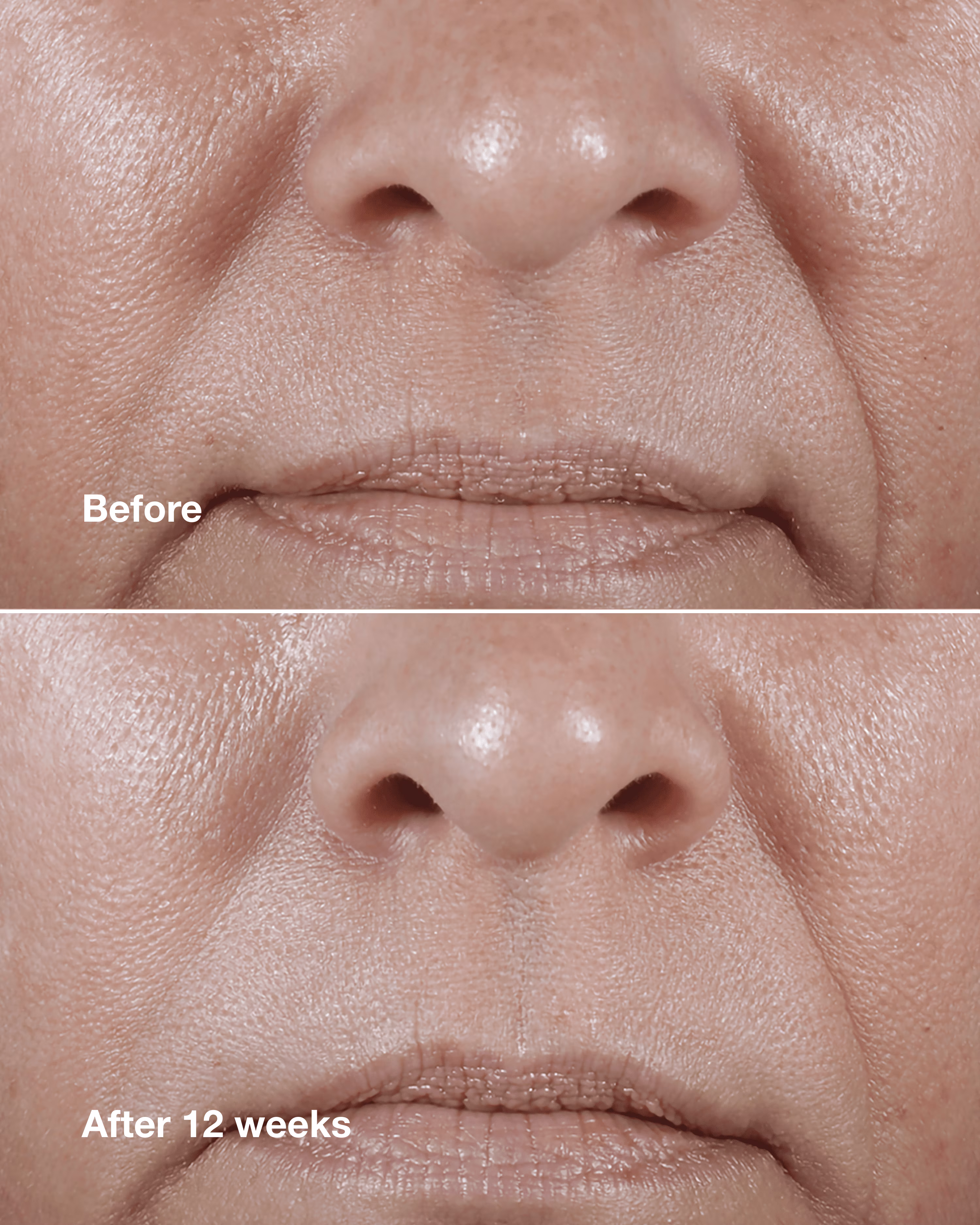 Clinique Smart Clinical Repair™ Wrinkle Correcting Rich Cream