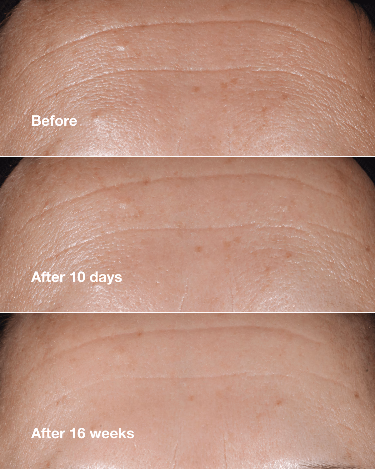 Clinique Smart Clinical Repair™ Wrinkle Correcting Serum