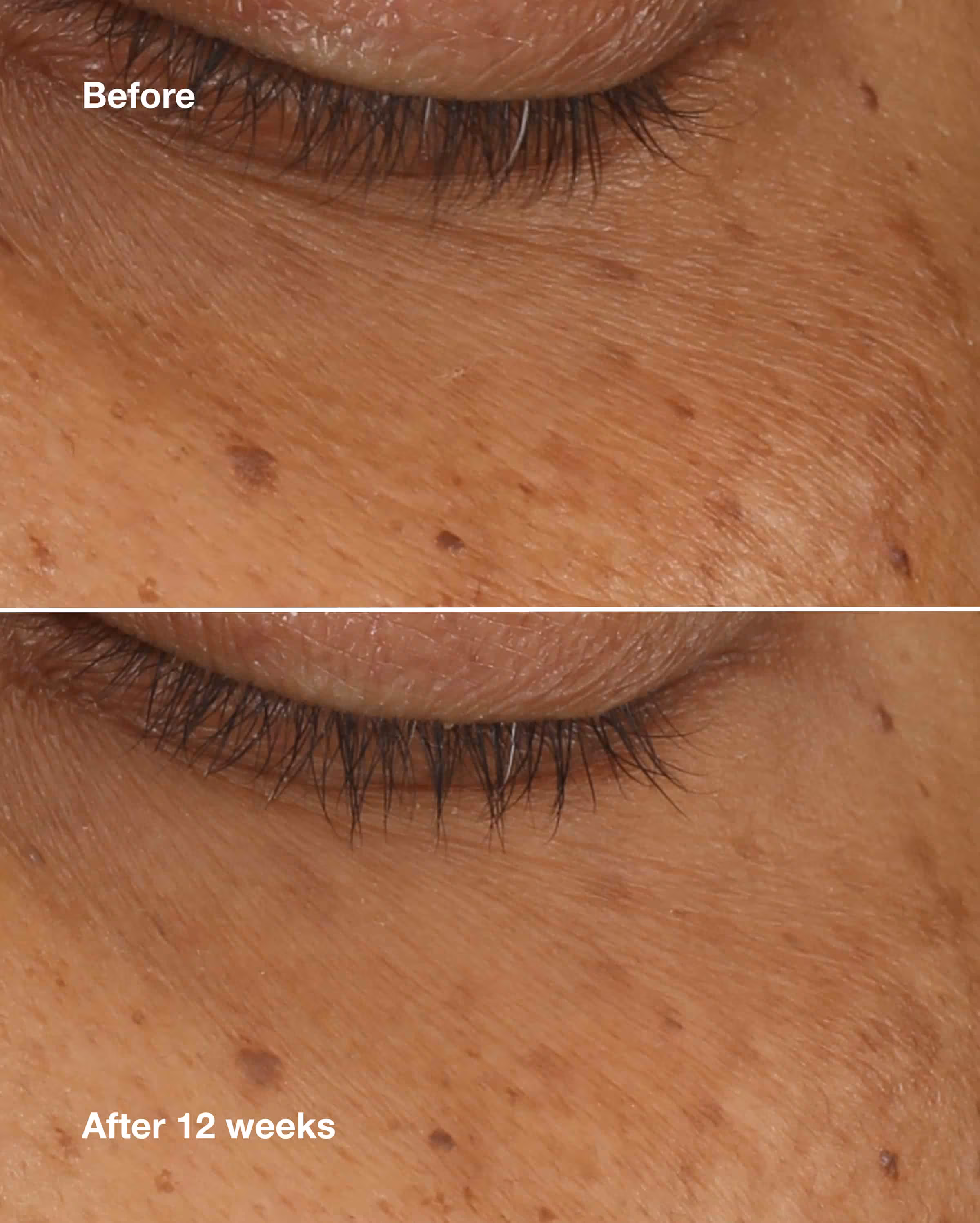 All About Eyes™ Brightening Serum Concentrate