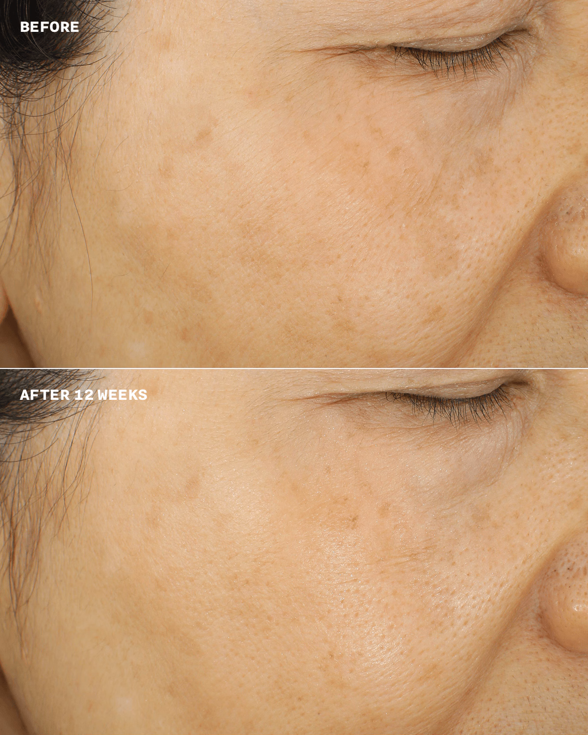 Even Better™ Brightening Essence Lotion